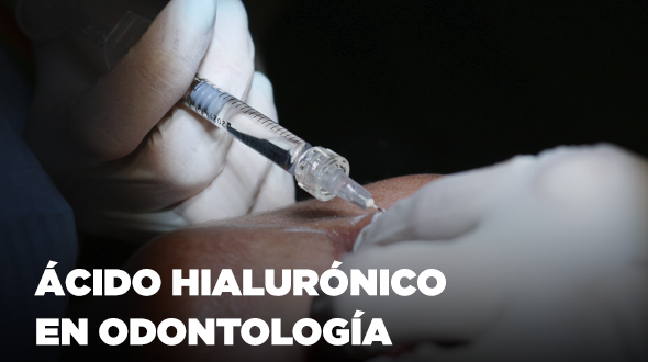 Curso Ácido Hialurónico en Odontología