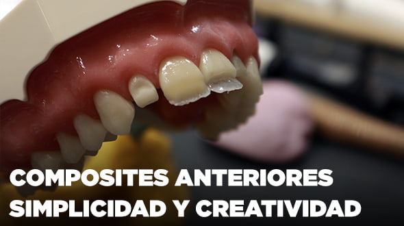 Curso Composites Anteriores: simplicidad y creatividad