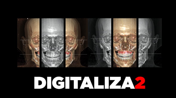 Curso Digitaliza2: Flujo Digital en Estética Dental