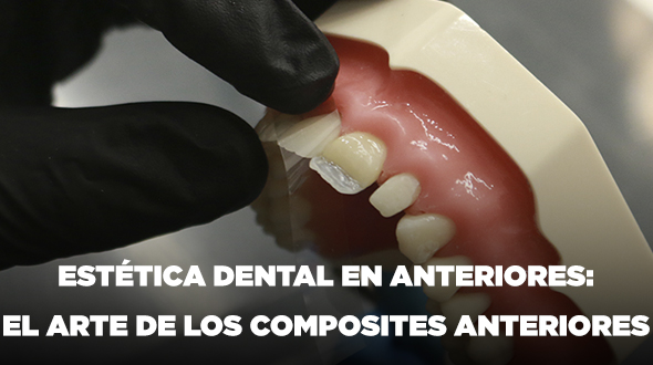 Curso “El arte de los composites anteriores” (Estética Dental Anteriores)