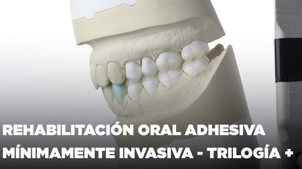 Curso de Carillas Cerámicas & Rehabilitación Oral Adhesiva Mínimamente Invasiva