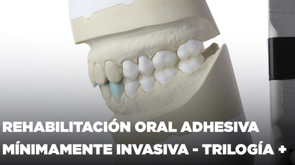 Curso Rehabilitación Oral Adhesiva Mínimamente Invasiva