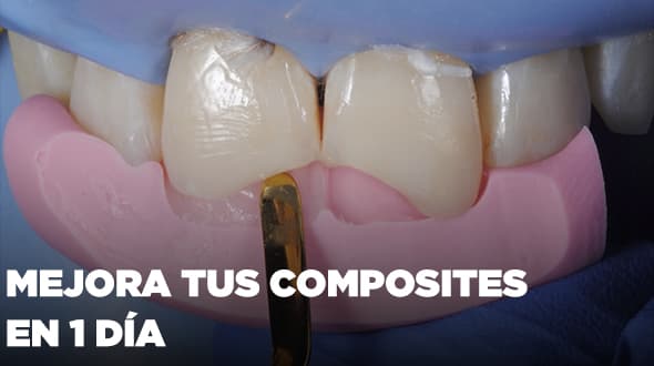 Curso Mejora tus Composites Anteriores en 1 día