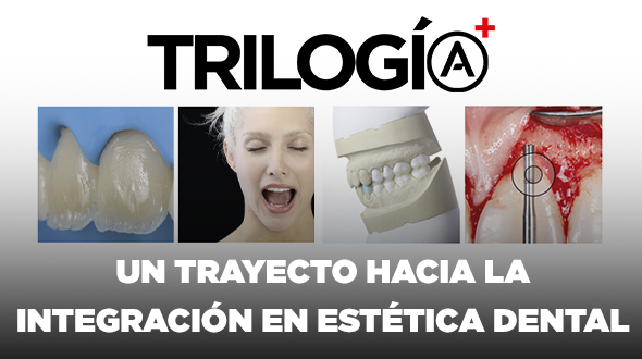 La Trilogía + (Plus) en Estética Dental