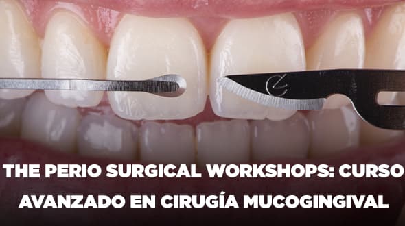 Curso Avanzado sobre Manejo de Recesiones en Dientes e Implantes