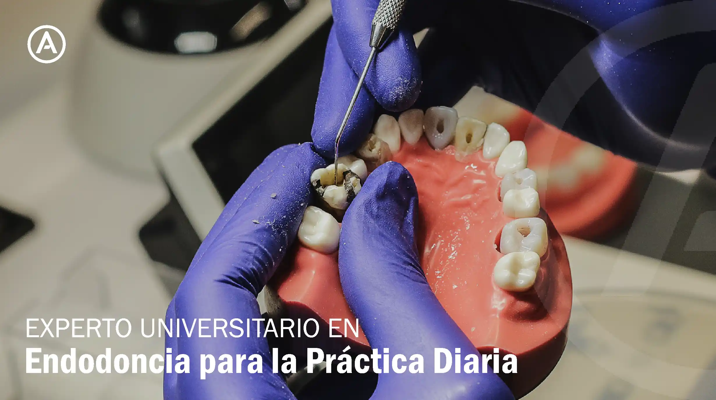 Experto Universitario en Endodoncia para la práctica diaria