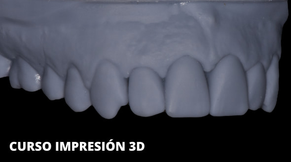 Curso Impresión 3D aplicada a la odontología