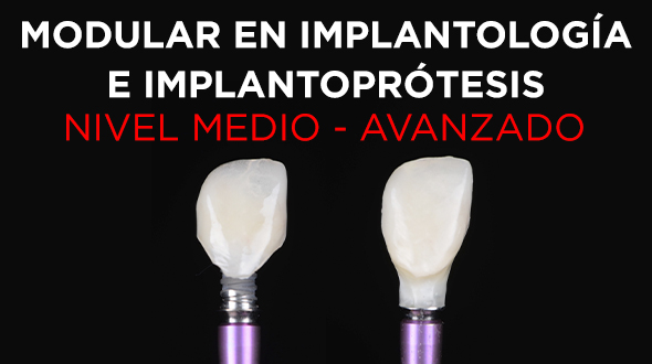 Modular en Implantología e Implantoprótesis: Nivel Medio – Avanzado
