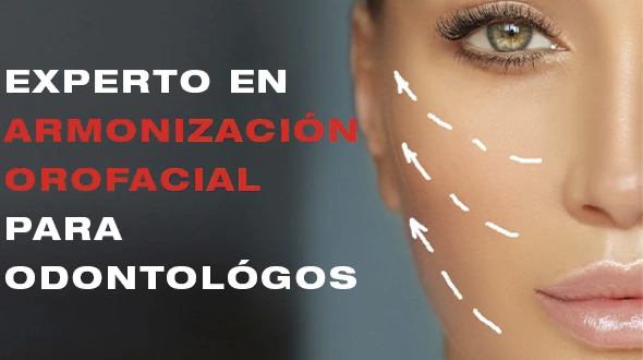 Experto en Armonización Orofacial Para Odontológos