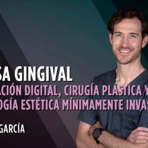 SONRISA GINGIVAL. Planificación Digital, Cirugía Plástica Y Odontología Estética Mínimamente Invasiva.