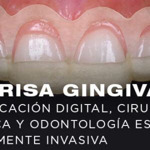MINIATURAS SONRISA GINGIVAL