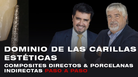 Dominio de las Carillas Estéticas: