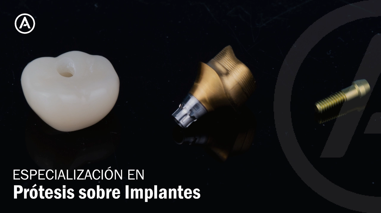 Especialización en Prótesis sobre implantes