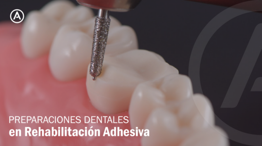 mini preparaciones dentales